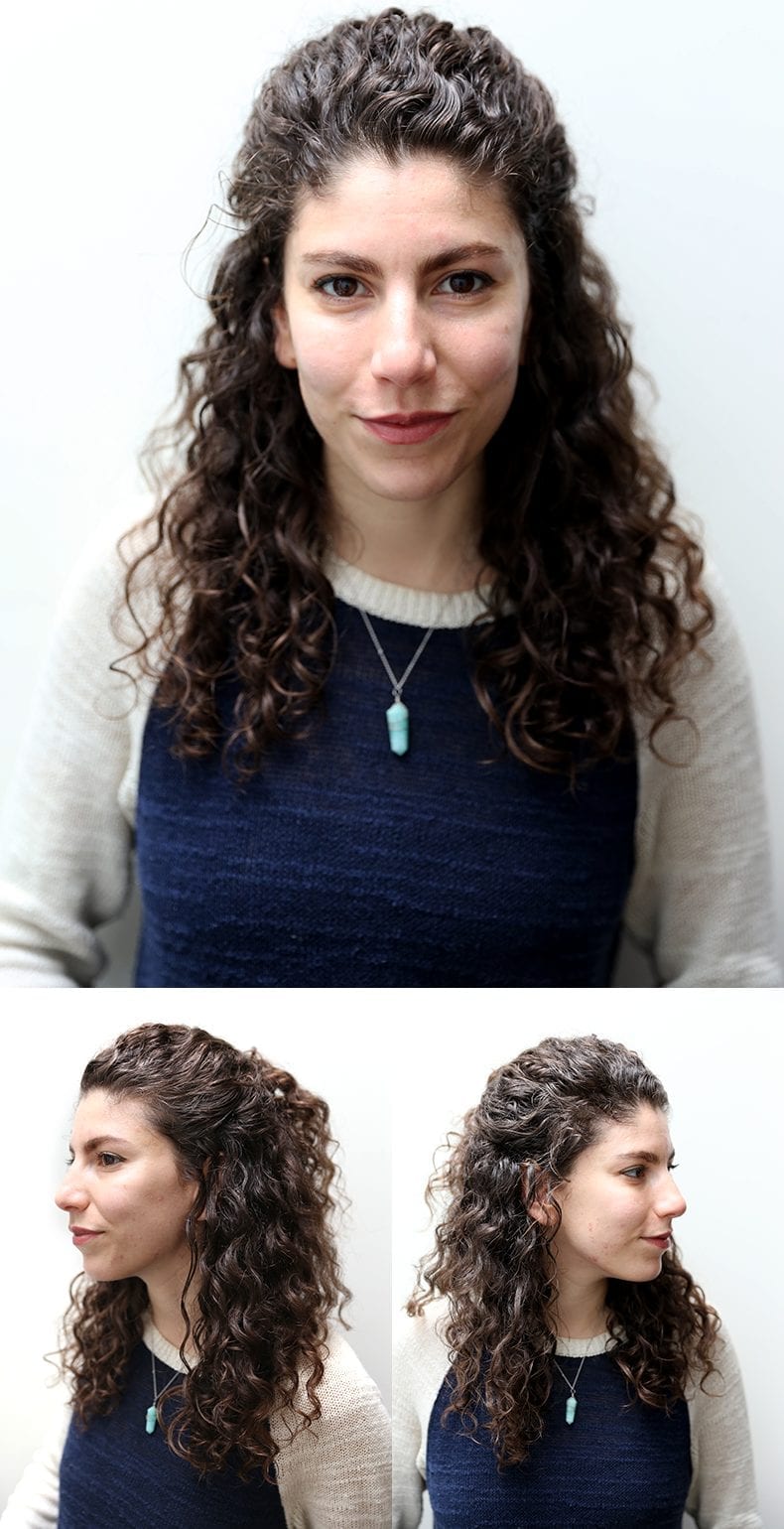 An acne update and my best acne-healing remedies